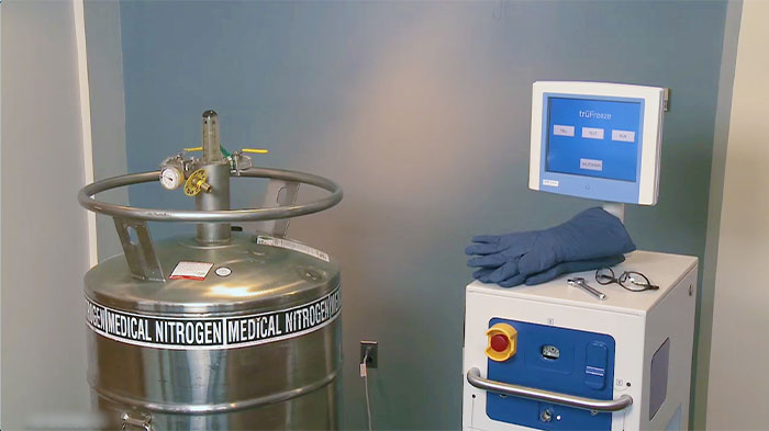 truFreeze® Spray Cryotherapy console filling - In-service Training